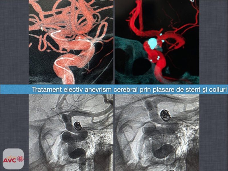 Xavcu1.jpg.pagespeed.ic.I403bX 3gl