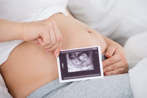 Asociația Moașelor din România: Sarcina la minore este o problemă majoră de sănătate publică și necesită măsuri urgente